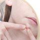 Illustration for article titled Earlier Puberty Sadly Means Earlier Acne for Unlucky Grade-Schoolers